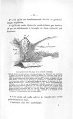 Les aponévroses et la loge de la vésicule séminale - Titres et travaux scientifiques du Dr Raoul Bau [...]