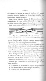 Fig. 2. L'aponévrose du G. D. a été retournée - Titres et travaux scientifiques du Dr Raoul Baudet,  [...]