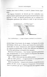 Fig. 8 (schématique). Coupe du lipome, montrant le sac herniaire - Titres et travaux scientifiques