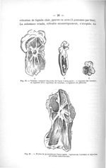 Fig. 20. Volume comparé des reins de lapus 3 mois après : a) ligature de l'uretère ; b) ligature ave [...]