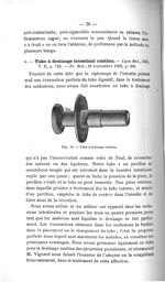 Fig. 52. Tube à drainage continu - Concours d'agrégation, chirurgie, 1907. Titres et travaux scienti [...]