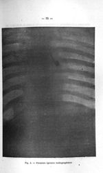 Fig. 2. Première épreuve radiographique - Concours d'agrégation de médecine, avril 1907. Exposé des  [...]