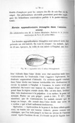 Fig. 20. Appendice avec le sillon d'étranglement - Exposé des titres & travaux scientifiques