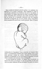 Fig. 8 - Concours d'agrégation, section chirurgie et accouchements. Titres et travaux scientifiques  [...]