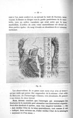 Fig. 15 - Concours d'agrégation, section chirurgie et accouchements. Titres et travaux scientifiques [...]