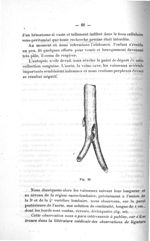 Fig. 20 - Concours d'agrégation, section chirurgie et accouchements. Titres et travaux scientifiques [...]