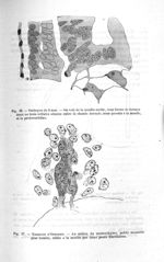 Fig. 36. Embryon de 8 mm / Fig. 37. Embryon d'Ophidien - Concours d'agrégation, section chirurgie et [...]