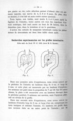 Fig. 1 / Fig. 2 - Concours d'agrégation de chirurgie. Mars 1907. Exposé des titres et travaux scient [...]