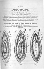 Fig. 7 / Fig. 8 / Fig. 9 - Concours d'agrégation de chirurgie. Mars 1907. Exposé des titres et trava [...]