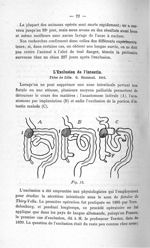 Fig. 12 - Concours d'agrégation de chirurgie. Mars 1907. Exposé des titres et travaux scientifiques