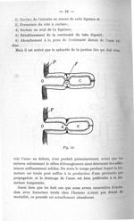 Fig. 14 - Concours d'agrégation de chirurgie. Mars 1907. Exposé des titres et travaux scientifiques
