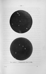 Fig. 9 et 10 Streptocoques dans le sang - Concours pour l'agrégation, 1907. Section de chirurgie et  [...]