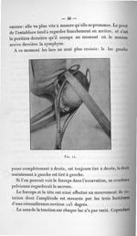 Fig. 11 - Concours pour l'agrégation, 1907. Section de chirurgie et d'accouchements. Titres et trava [...]