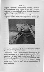 Fig. 12 - Concours pour l'agrégation, 1907. Section de chirurgie et d'accouchements. Titres et trava [...]