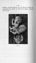 Fig. 13 - Concours pour l'agrégation, 1907. Section de chirurgie et d'accouchements. Titres et trava [...]