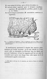 Fig. 1. Ligature de l'épiploon - Titres et travaux scientifiques