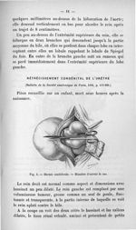 Fig. 3. Hernie ombilicale - Titres et travaux scientifiques