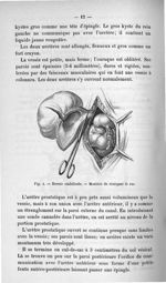 Fig. 4. Hernie ombilicale - Titres et travaux scientifiques