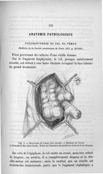 Fig. 5. Résection de l'anse iléo-caecale - Titres et travaux scientifiques