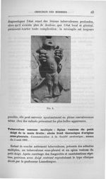 Fig. 2 - Titres et travaux scientifiques du Dr Joseph Guyot...concours pour l'agrégation, 1907, sect [...]