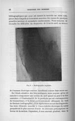 Fig. 5. Radiographie sagittale - Titres et travaux scientifiques du Dr Joseph Guyot...concours pour  [...]