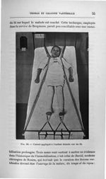Fig. 22. Corset appliqué à l'enfant étendu sur un lit - Titres et travaux scientifiques du Dr Joseph [...]