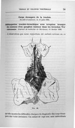 Fig. 24 - Titres et travaux scientifiques du Dr Joseph Guyot...concours pour l'agrégation, 1907, sec [...]