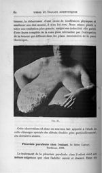 Fig. 25 - Titres et travaux scientifiques du Dr Joseph Guyot...concours pour l'agrégation, 1907, sec [...]