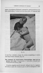 Fig. 26 - Titres et travaux scientifiques du Dr Joseph Guyot...concours pour l'agrégation, 1907, sec [...]
