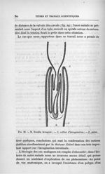 Fig. 28. B, Boudin invaginé ; C, collier d'invagination ; F, gaine - Titres et travaux scientifiques [...]