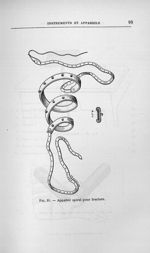 Fig. 31. Appareil spiral pour fracture - Titres et travaux scientifiques du Dr Joseph Guyot...concou [...]