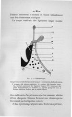 Fig. 1. Schématique - Concours pour l'agrégation, 1907, section de pathologie externe et d'accouchem [...]