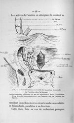 Fig. 3. Vascularisation artérielle de la portion terminale de l'uretère chez la femme - Concours pou [...]
