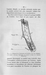 Fig. 4. Rapports de l'adventice de l'uretère avec les vaisseaux - Concours pour l'agrégation, 1907,  [...]