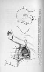 Fig. 15. Le jour que donne l'hémisection de l'hyoïde sans incision latérale - Concours pour l'agréga [...]