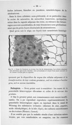 Fig. 31. Coupe de l'épiploon au niveau d'un îlot de stéatonécrose - Titres et travaux scientifiques
