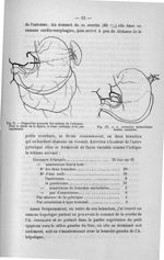 Fig. II. Disposition normale des artères de l'estomac / Fig. III. A. Coronaire stomachique double. A [...]