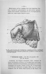 Fig. XII. Cancer de l'antre - Concours d'agrégation, chirurgie, 1907. Titres et travaux scientifique [...]