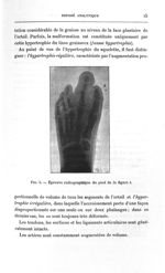 Fig. 5. Épreuve radiographique du pied de la figure 4 - Titres et travaux scientifiques
