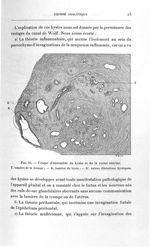 Fig. 10. Coupe d'ensemble du kyste et de la corne utérine - Titres et travaux scientifiques
