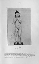 Fig. 1. G. Anne, 10 ans - Titres et travaux scientifiques