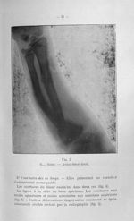 Fig. 5. G... Anne. - Avant-bras droit - Titres et travaux scientifiques