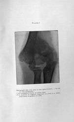 Radiographie faite deux mois et demi après l'accident - Titres et travaux scientifiques