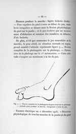 Fig. 7. Flexion complète de la phalangette du gros orteil sur la phalange. - Attitude prise pendant  [...]