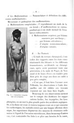 Fig. 3. Luxation congénitale de la hanche - Titres et travaux