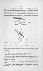 Fig. 18. Schéma expliquant le mécanisme de la chute dans les luxations intermittentes de la rotule - [...]
