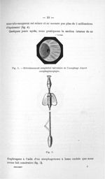 Fig. 4. Rétrécissement congénital valvulaire de l'oesophage / Fig. 5 - Titres et travaux scientifiqu [...]