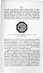 Fig. 10. Rétrécissement cicatriciel de l'oesophage - Titres et travaux scientifiques