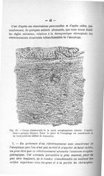 Fig. 12. Coupe transversale de la paroi oesophagienne rétrécie - Titres et travaux scientifiques