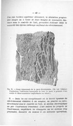 Fig. 13. Coupe transversale de la paroi diverticulaire - Titres et travaux scientifiques